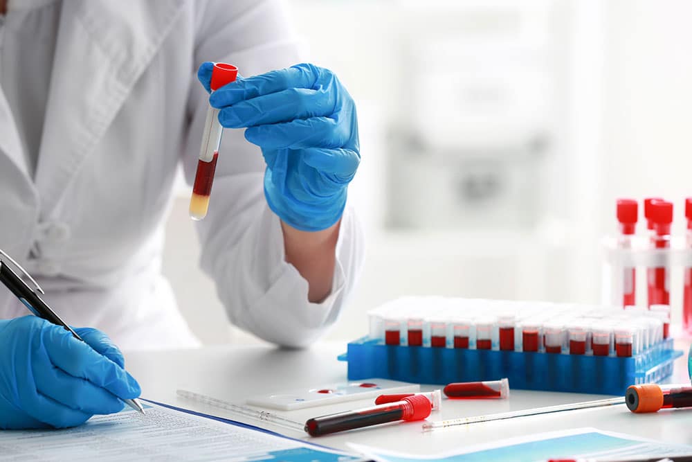 Veterinarian analyzing a dog blood sample for diagnostic testing in a laboratory.