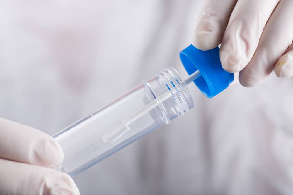 Close-up of a healthcare professional handling a sample container for DNA-based stool testing to detect colorectal cancer markers.